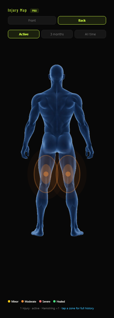 GRAFT body map showing an active hamstring strain